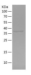    ATP1B1 / Recombinant Human ATP1B1