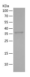    APOB / Recombinant Human APOB