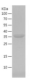    ATG5 / Recombinant Human ATG5