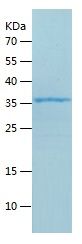    DGAT1 / Recombinant Human DGAT1