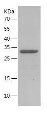    CD81 / Recombinant Human CD81