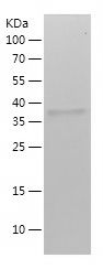    KRT15 / Recombinant Human KRT15