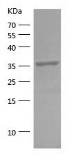    FBP1 / Recombinant Human FBP1