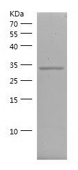    CDK4 / Recombinant Human CDK4