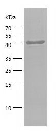    CD44 / Recombinant Human CD44