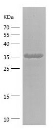    CRAT / Recombinant Human CRAT