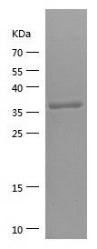    SLC1A2 / Recombinant Human SLC1A2