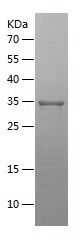    EIF4A2 / Recombinant Human EIF4A2