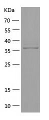    DENND3 / Recombinant Human DENND3