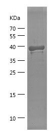    EIF2A / Recombinant Human EIF2A