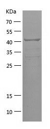    DICER1 / Recombinant Human DICER1