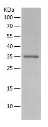    CD9 / Recombinant Human CD9