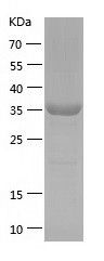    EIF1AY / Recombinant Human EIF1AY