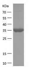    FIS1 / Recombinant Human FIS1