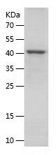    EGFR / Recombinant Human EGFR