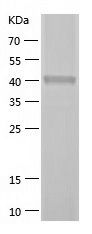    DGKH / Recombinant Human DGKH