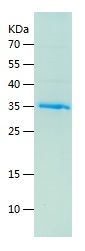    FBLN1 / Recombinant Human FBLN1