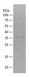    MET / Recombinant Human MET