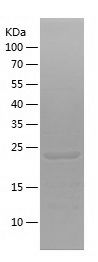    FGD5 / Recombinant Human FGD5