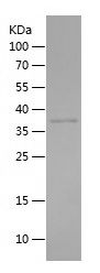    AKR1CL2 / Recombinant Human AKR1CL2