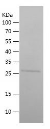    GADD34 / Recombinant Human GADD34