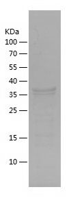    KRT20 / Recombinant Human KRT20