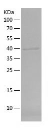    DMC1 / Recombinant Human DMC1