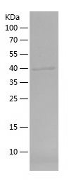    DMC1 / Recombinant Human DMC1