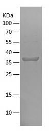    LDLR / Recombinant Human LDLR