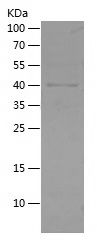    ADA / Recombinant Human ADA