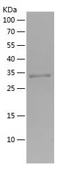    MARC2 / Recombinant Human MARC2