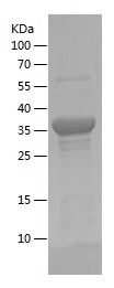    DAB2 / Recombinant Human DAB2