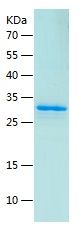    DKK2 / Recombinant Human DKK2