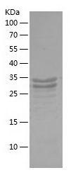    GALP / Recombinant Human GALP