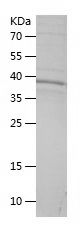    DLAT / Recombinant Human DLAT