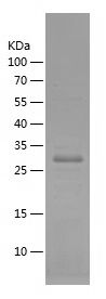    CXCR4 / Recombinant Human CXCR4