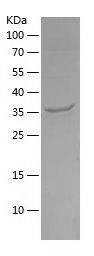    ATP5F1C / Recombinant Human ATP5F1C