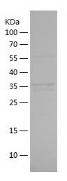    CDK1 / Recombinant Human CDK1