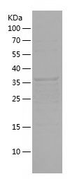    GLUL / Recombinant Human GLUL