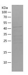    FOXO6 / Recombinant Human FOXO6