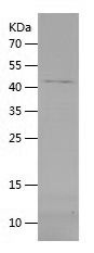    DNMT3A / Recombinant Human DNMT3A