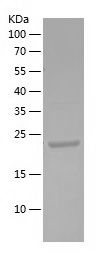    KRT13 / Recombinant Human KRT13