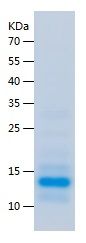    ADRA2B / Recombinant Human ADRA2B