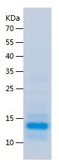    ADRA2B / Recombinant Human ADRA2B