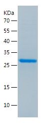    CXorf61 / Recombinant Human CXorf61