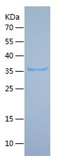    KRT1 / Recombinant Human KRT1