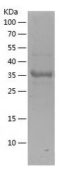    CFHR3 / Recombinant Human CFHR3