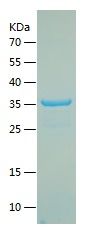    JAK2 / Recombinant Human JAK2