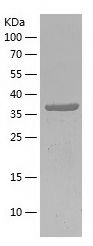    CIRBP / Recombinant Human CIRBP