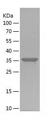    ITGB5 / Recombinant Human ITGB5